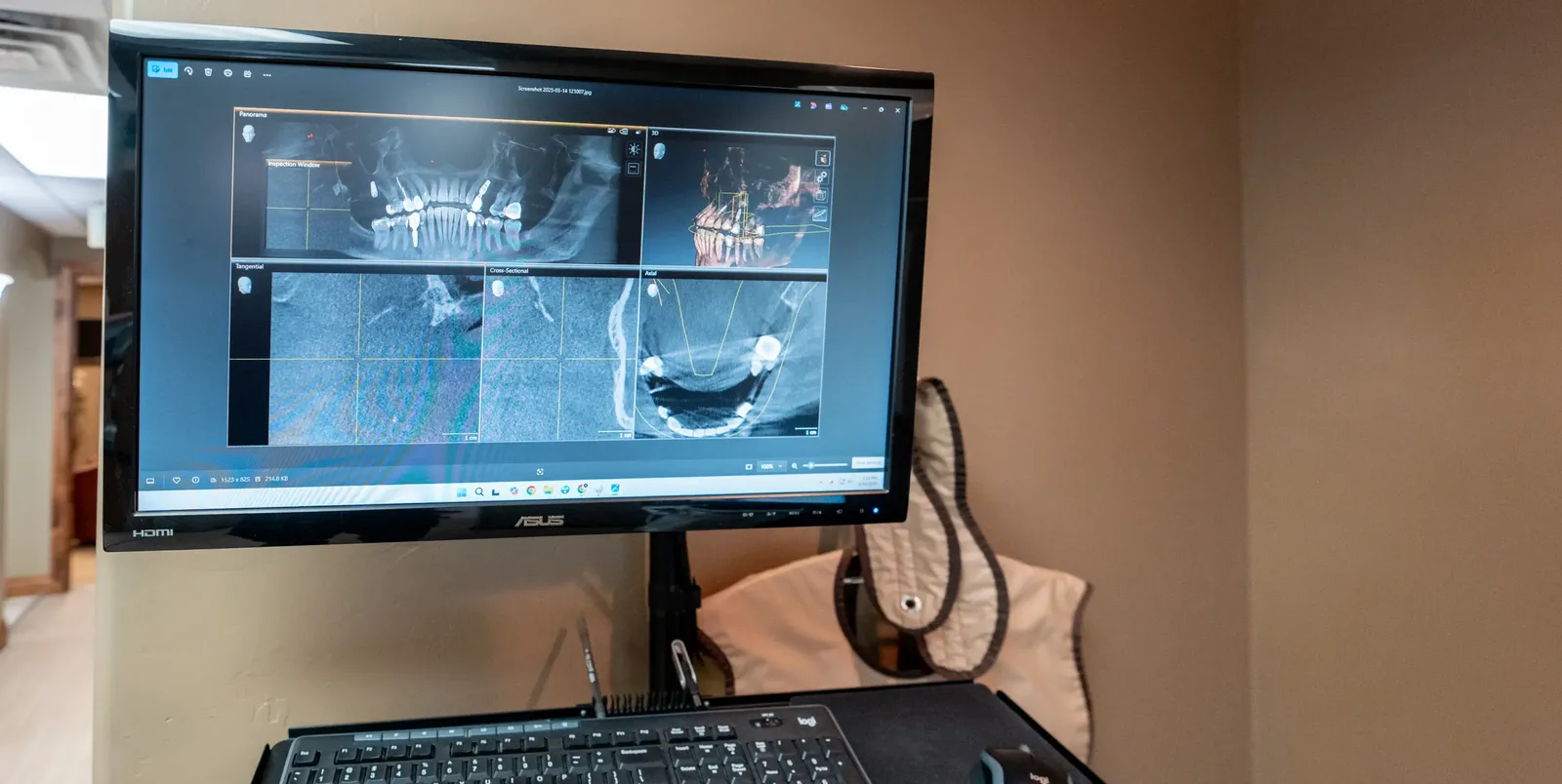 Digital 3D x-ray scan on a monitor at the Cottonwood Heights office | Complete Smiles-Cottonwood Heights-Mountain View-Redwood-Utah